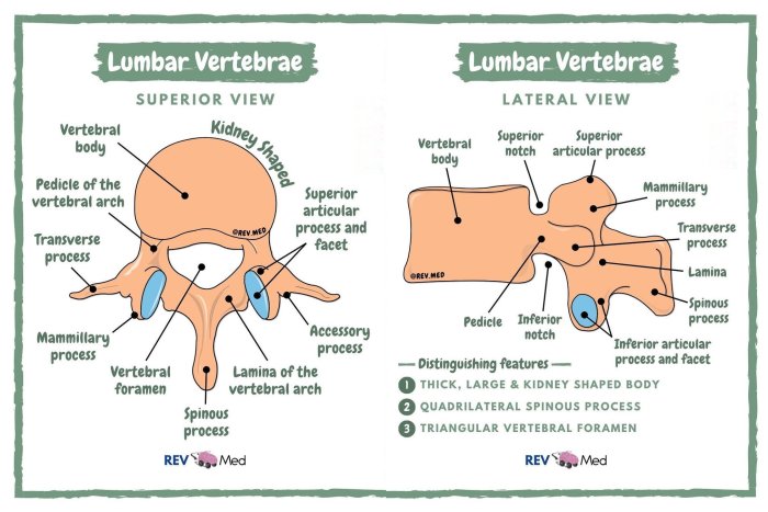 Lumbar lateral labeled forsman vertebra